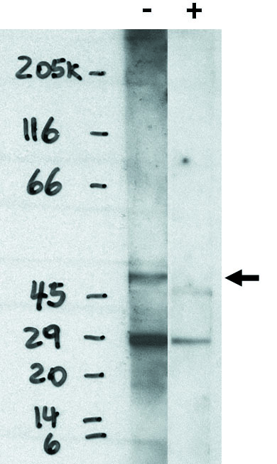 "
Western blot analysis using EDG6 (S1P4) antibody on RH7777 cells transfected with EDG6 (S1P4) protein in the presence (1) and absence (+) of specific blocking peptide."